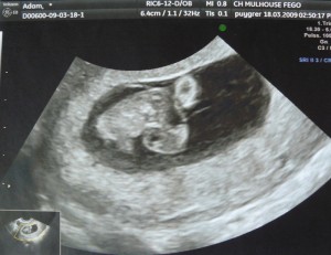 un haricot de 6 semaines