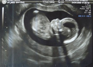 un asticot de 3 mois